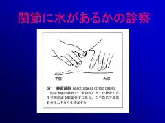 膝に水がたまるとは はやし整形外科